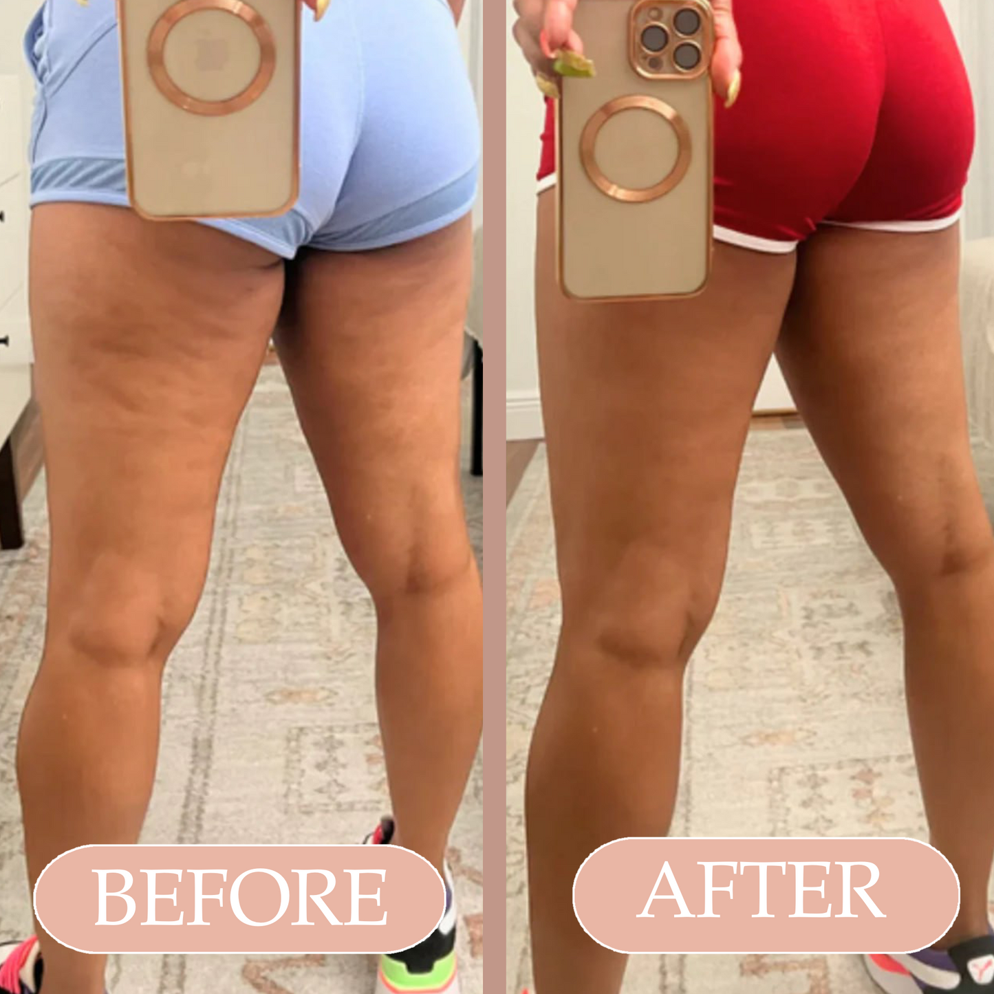 Chic Skin™ Cellulite Therapy