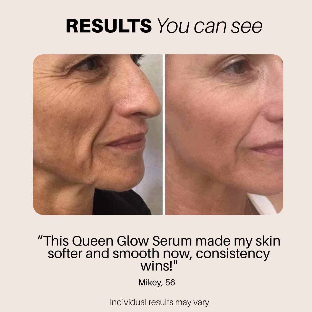 Queen Glow™ Serum