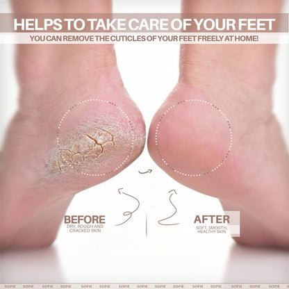 Pedi Perfect Callus Polish™